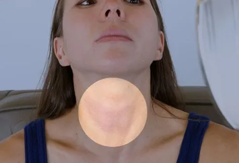 Examining your neck in the area of the Adam's apple while you swallow can sometimes detect if your thyroid is enlarged.