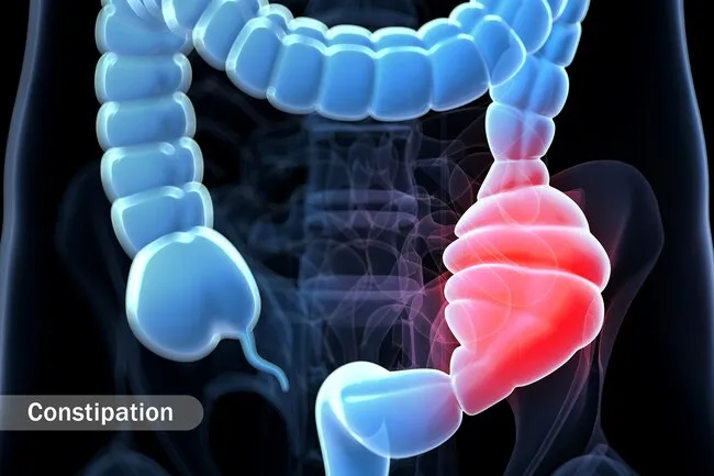 If there aren't enough carbs in your diet, you could get constipated from lack of fiber and nutrients.