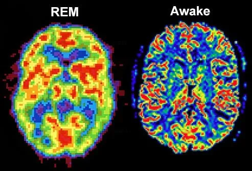 When you close your eyes and start to drift into non-REM sleep, your brain cells settle down from their daytime activity levels and start firing in a steady, more rhythmic pattern.