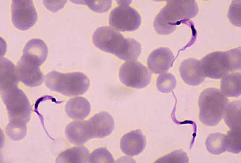 This parasite causes Chagas disease, which can be life-threatening.