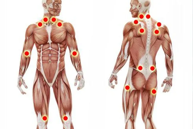 Fibromyalgia is associated with joint and muscle pain. 