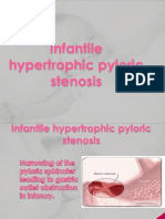 Pyloric Stenosis