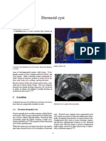 Dermoid Cyst