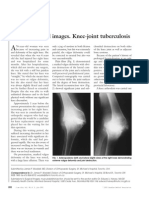 Musculoskeletal Images. Knee-Joint Tuberculosis: Surgical Images Imagier Chirurgical