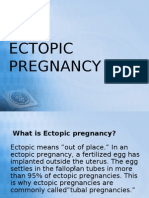 Ectopic Pregnancy Case Study