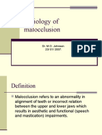 Aetiology of Malocclusion