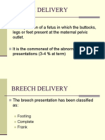 Breech Delivery PDF