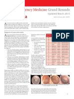 Otitis Media