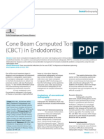 Cone Beam Computed Tomography (CBCT) in Endodontics