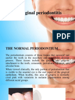 Chronic Marginal Periodontitis