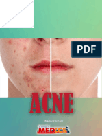 Acne PDF