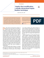 Trailing-Haptic-First Modification of Double-Needle Intrascleral Haptic Fixation Technique