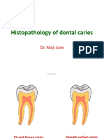 Caries Histopathology