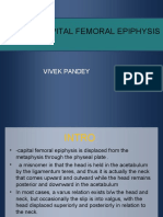 Slipped Capital Femoral Epiphysis: Vivek Pandey