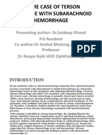 A Rare Case of Terson Syndrome With Subarachnoid Hemorrhage