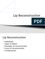 Lip Reconstruction