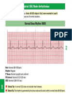 Ecg Strips