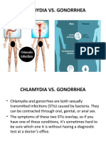 Chlamydia Vs Gonorrhoea