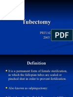 C12 P13 Tubectomy