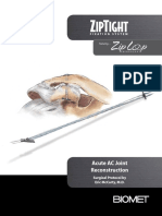 Ziptight Fixation System For Acute Ac Joint Reconstruction Surgical Technique