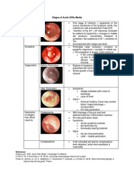 Stages of Acute Otitis Media