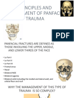 Principles and Management of Panfacial Trauma