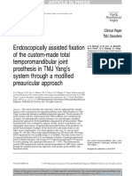 Endoscopically Access YANG - TMJ Prosthesis