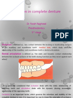 Occlusion