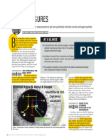 CRSTE0418 - Fundamentals - Holladlay - Kappa Angle