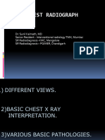 CHEST X-Ray