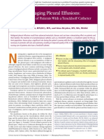 Managing Pleural Effusions Nursing Care of Patients With A Tenckhoff Catheter