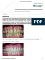 gingivitis medscape