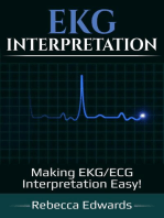 EKG Interpretation: Making EKG/ECG Interpretation Easy!