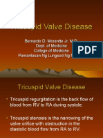 Tricuspid Valve Disease