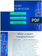 Heart Transplantation