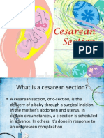 Cesarean Section