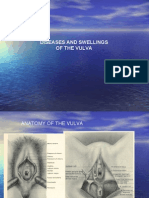 Diseases of The Vulva and Vagina