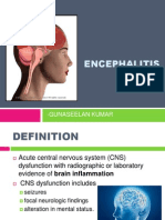 Encephalitis: - Gunaseelan Kumar