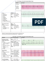 EKG Examples