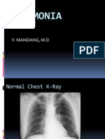 Pneumonia: V. Mandang, M.D