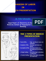 Mechanism of Labor in Breech Presentation