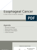 Esophageal Cancer