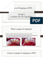 GROUP E - Gingival Stripping in RPD