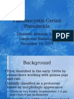 Pneumonitis Akibat Pneumocystis Carinii