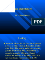 Retinoblastoma Case Presentation