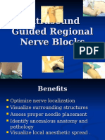 Ultrasound Guided Regional Nerve Blocks