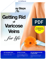 Guide To Getting Rid of Varicose Veins