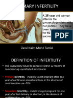 Primary Infertility: Zarul Naim Mohd Tamizi