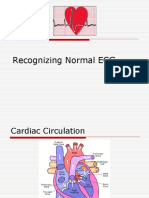 Recognizing Normal ECG