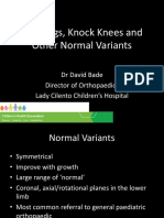 Bow Legs, Knock Knees and Other Normal Variants: DR David Bade Director of Orthopaedics Lady Cilento Children's Hospital